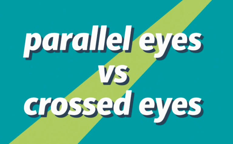 Parallel Eyes Vs. Crossed Eyes
